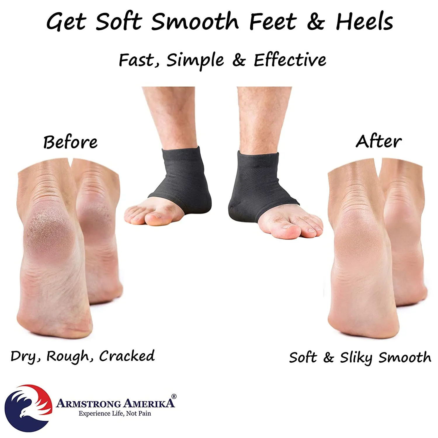Moisturizing Socks for Mens Cracked Heels - Moisturizer Heel Sleeves to Smooth & Soften Rough Cracked Heels & Dry Feet. Large Aloe Moisturizing Heel Socks with Lotion Infused Gel Socks (XL - 3 Pairs)